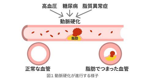 挿入 萎える|中折れとは｜原因や対策について詳しく解